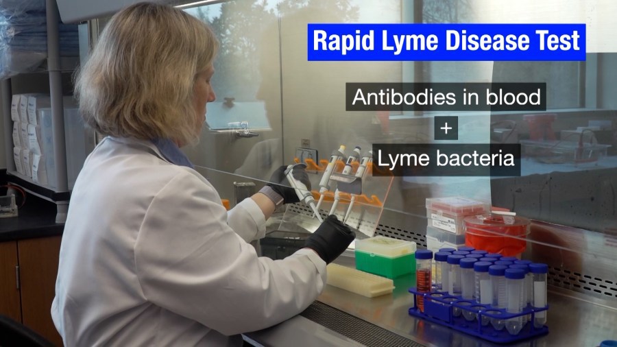 Your Health New Lyme disease tests providing quicker diagnosis